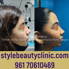 dr charbel medawar expert rhinoplasty lebanon