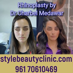 dr charbel medawar style beauty clinic best nose doctor in lebanon