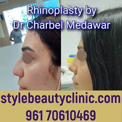 dr charbel medawar style beauty clinic bet nose job doctor in lebanon