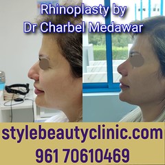 dr charbel medawar style beauty clinic plastic surgery