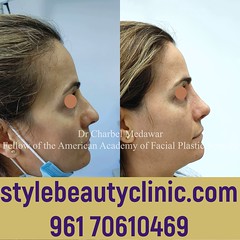 dr charbel medawar style beauty clinic top facial plastic surgeon lebanon