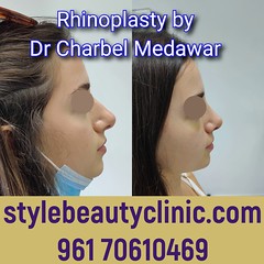 dr charbel medawar style beauty clinic top rhinoplasty doctor in lebanon