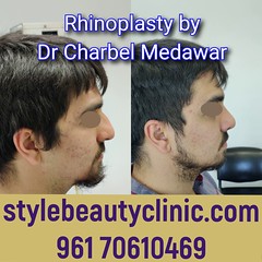 dr charbel medawar style beauty clinic top rhinoplasty surgeon in lebanon