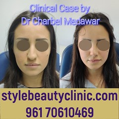 dr charbel medawar top facial plastic surgeon in lebanon